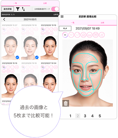 過去の肌診断画像と比較